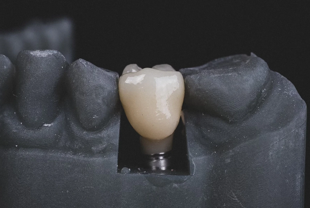 インプラントの<br class="sp">メンテナンス方法とは？<br>費用の目安や適切な<br class="sp">通院頻度について解説